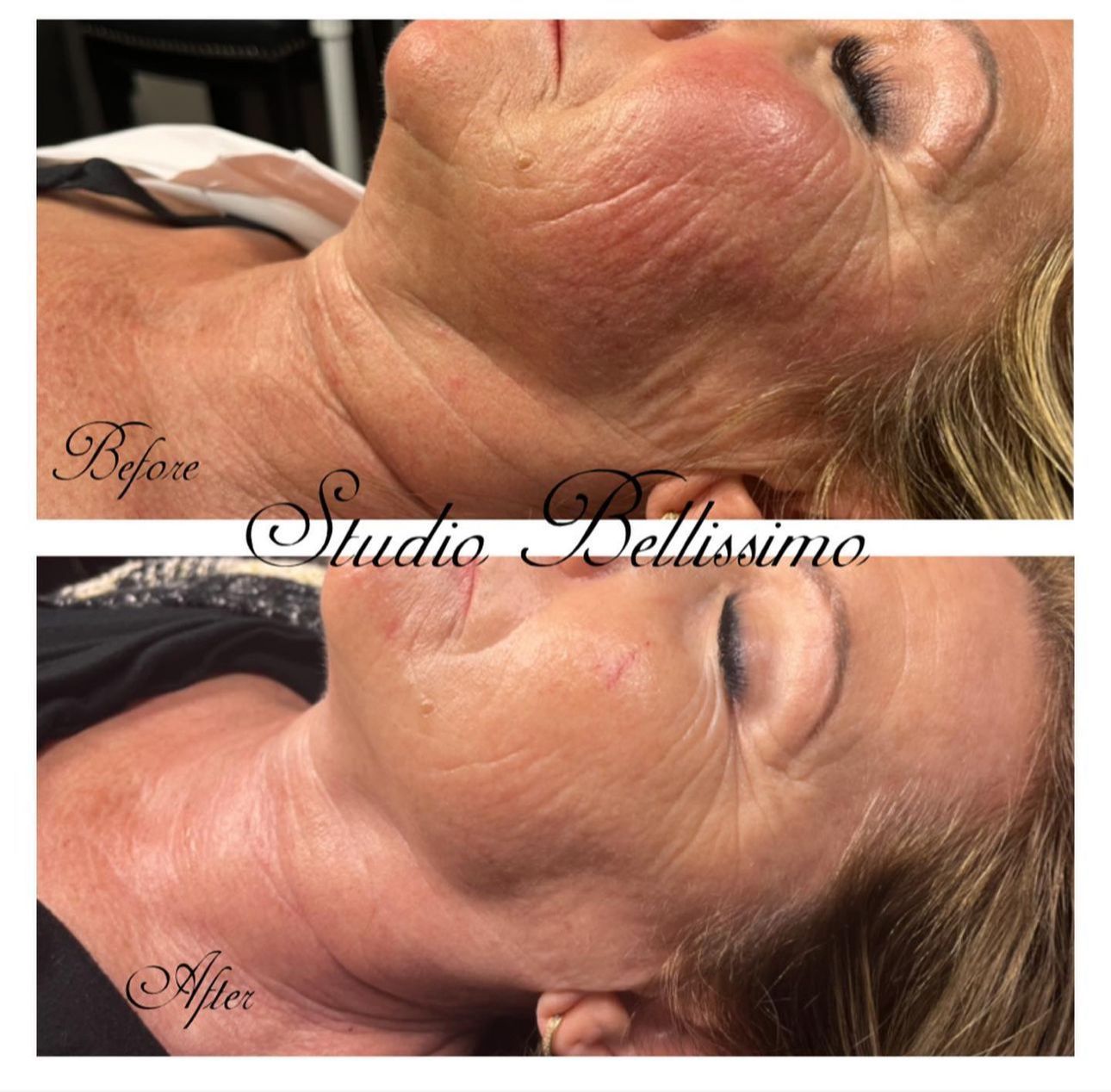 Renewed Med Spa & Tanning - Facility Photo