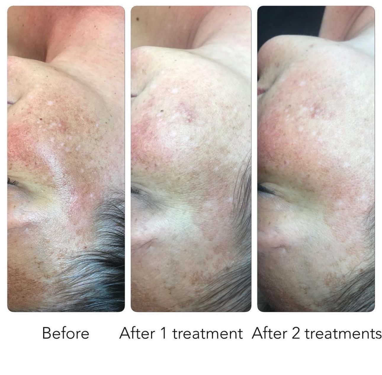 Renewed Med Spa & Tanning - Facility Photo