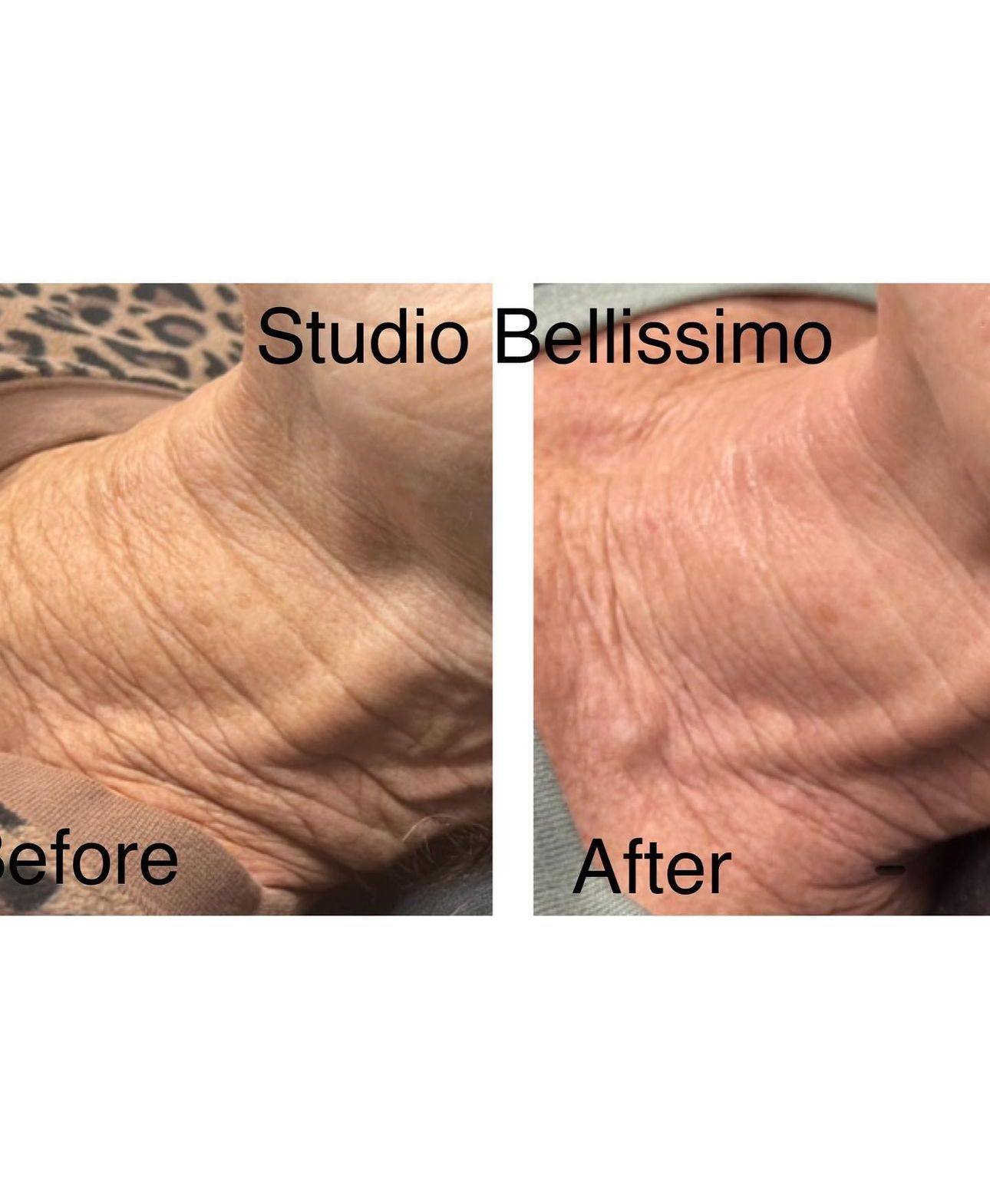 Renewed Med Spa & Tanning - Facility Photo